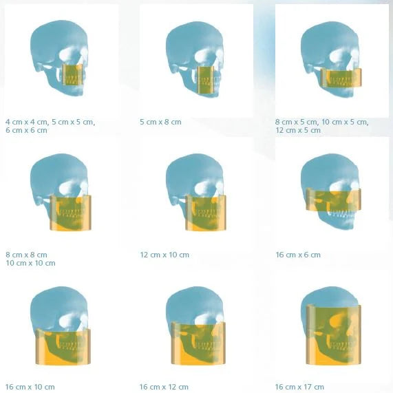 Tomógrafo Dental CS 9600 -Carestream Dental